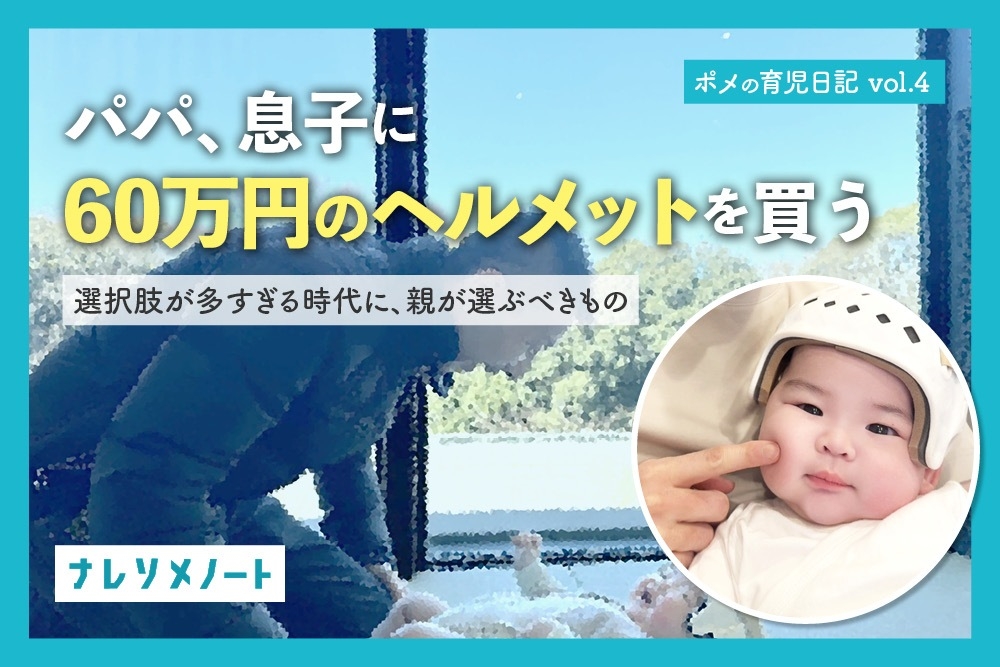 【ポメの育休日記 vol.4】赤ちゃんの頭の形、治すべき？ ヘルメット治療の必要性や費用を経験者が語る